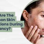 What Are the Common Skin Conditions During Pregnancy?