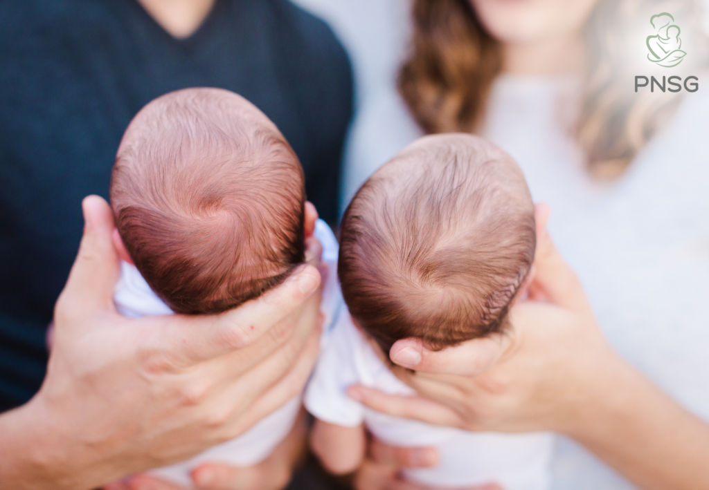 Postpartum Hair Loss With Twins Or Multiples: What to Expect Postpartum Hair Loss With Twins Or Multiples: What to Expect
